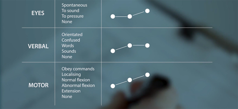 Video still showing the Coma Scale chart